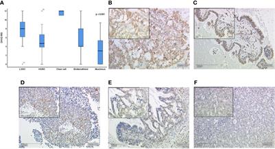 G Protein-Coupled Estrogen Receptor Correlates With Dkk2 Expression and Has Prognostic Impact in Ovarian Cancer Patients